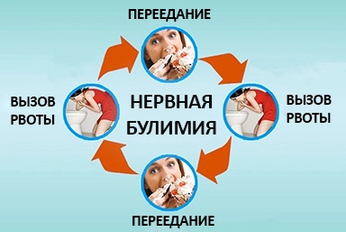 Лечение булимии в Нефтекумске